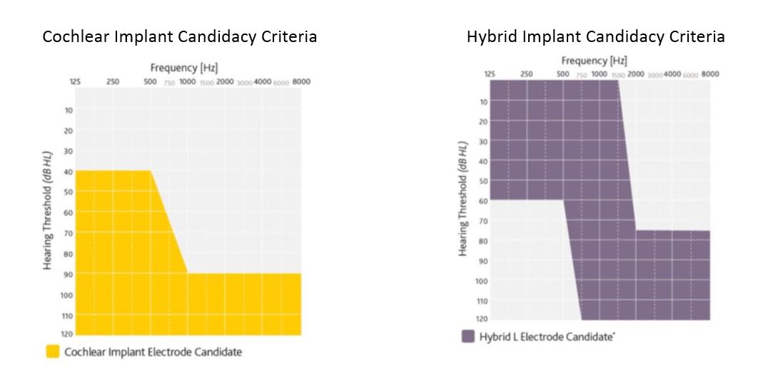 Cochlear™ Nucleus® implant candidacy and indications for adult and