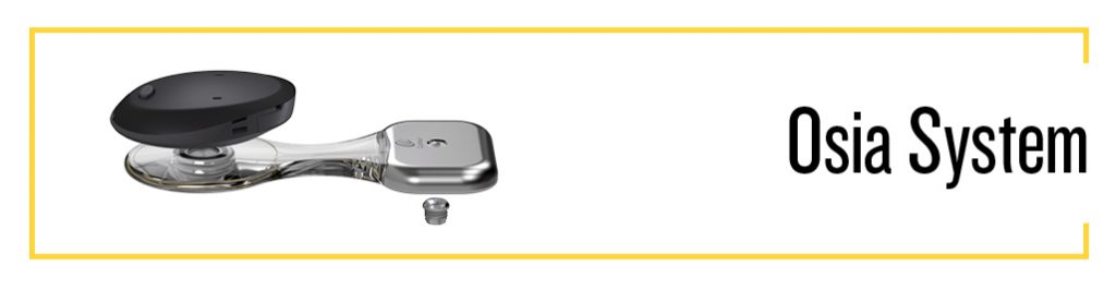 Osia System Cochlear Implant Pronews