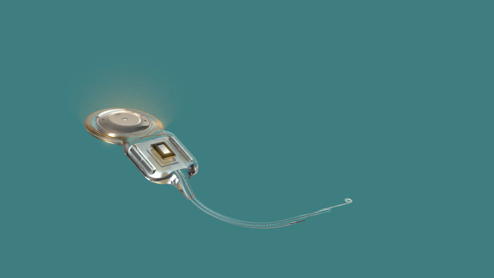 What is a SMART cochlear implant? - Cochlear ProNews